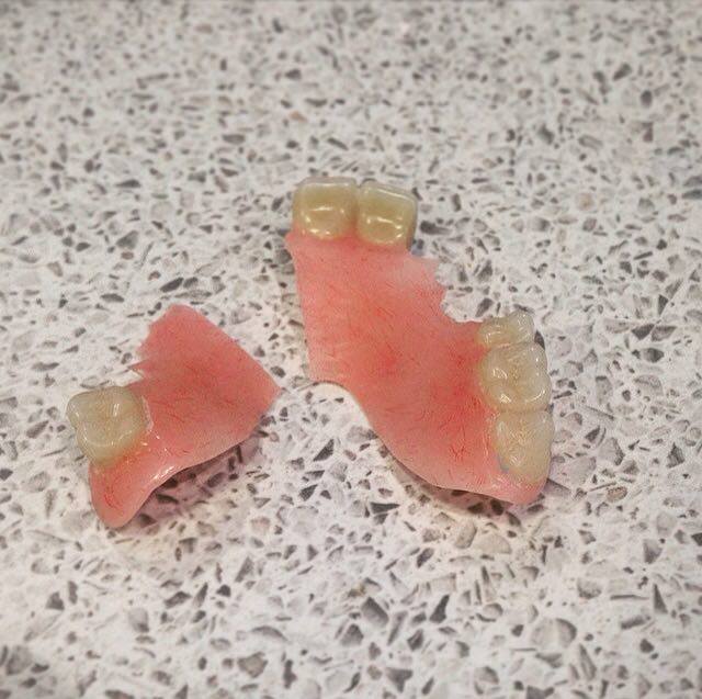 Denture Repair Dental Blog Adam Norris Dental Labaratory