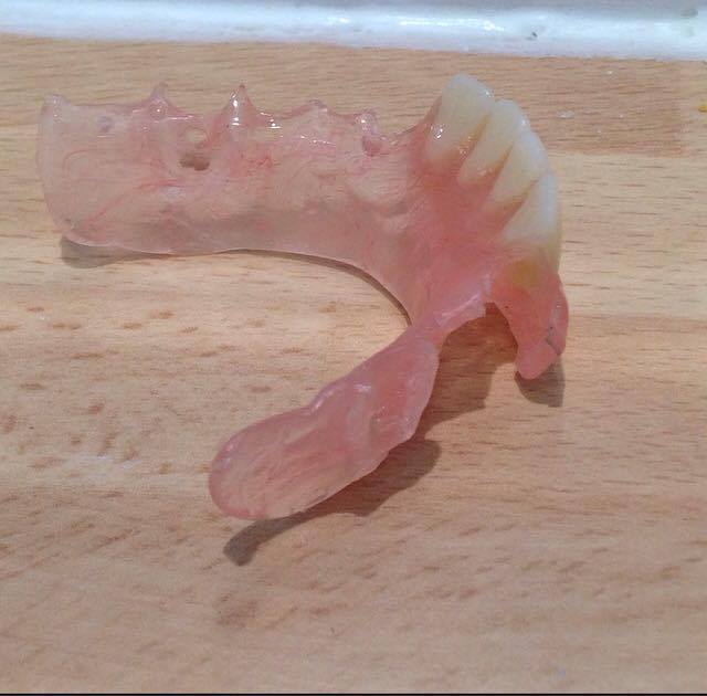 Dog Denture Dental Blog Adam Norris Dental Labaratory