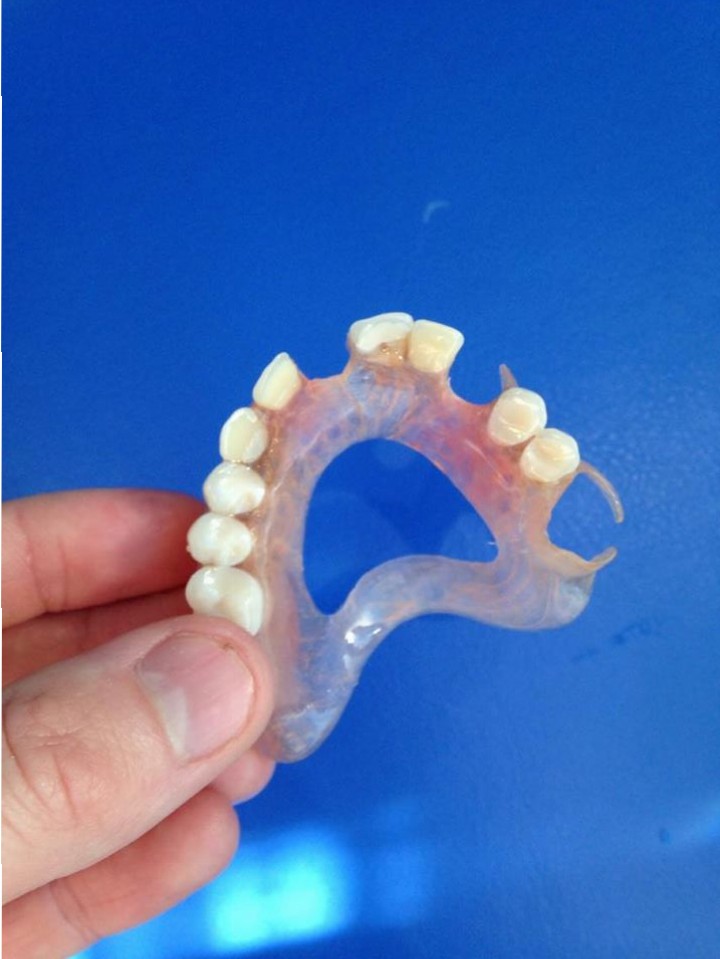Flexiblerepair Dental Blog Adam Norris Dental Labaratory