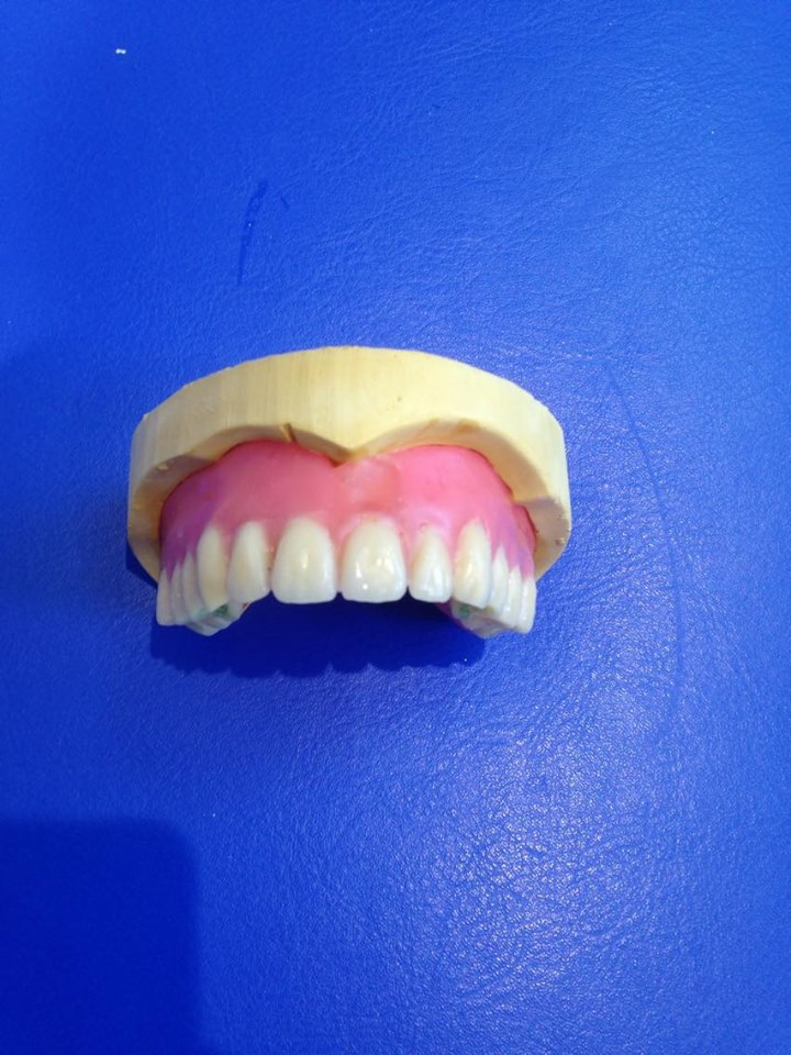 Add Of Tooth Dental Blog Adam Norris Dental Labaratory