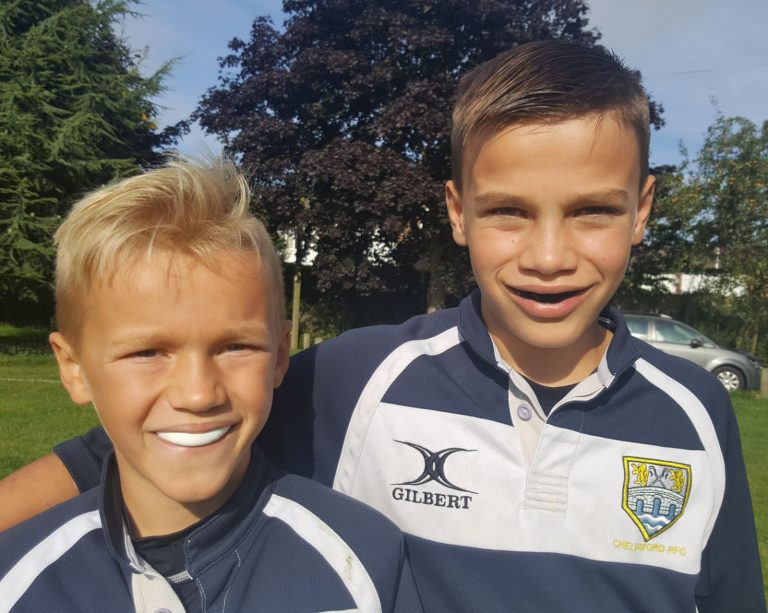 Sports Guards Dental Blog Adam Norris Dental Labaratory